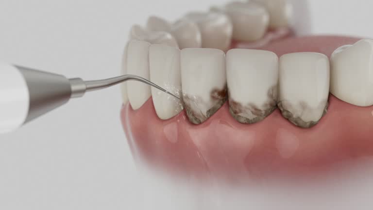 Reliable Dental Implants contractor in West Hill, OH by Smile Center Dentistry